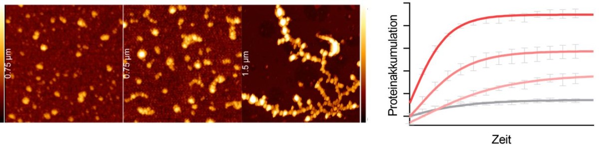 Proteinverklumpung bei Amyotrophe Lateralsklerose