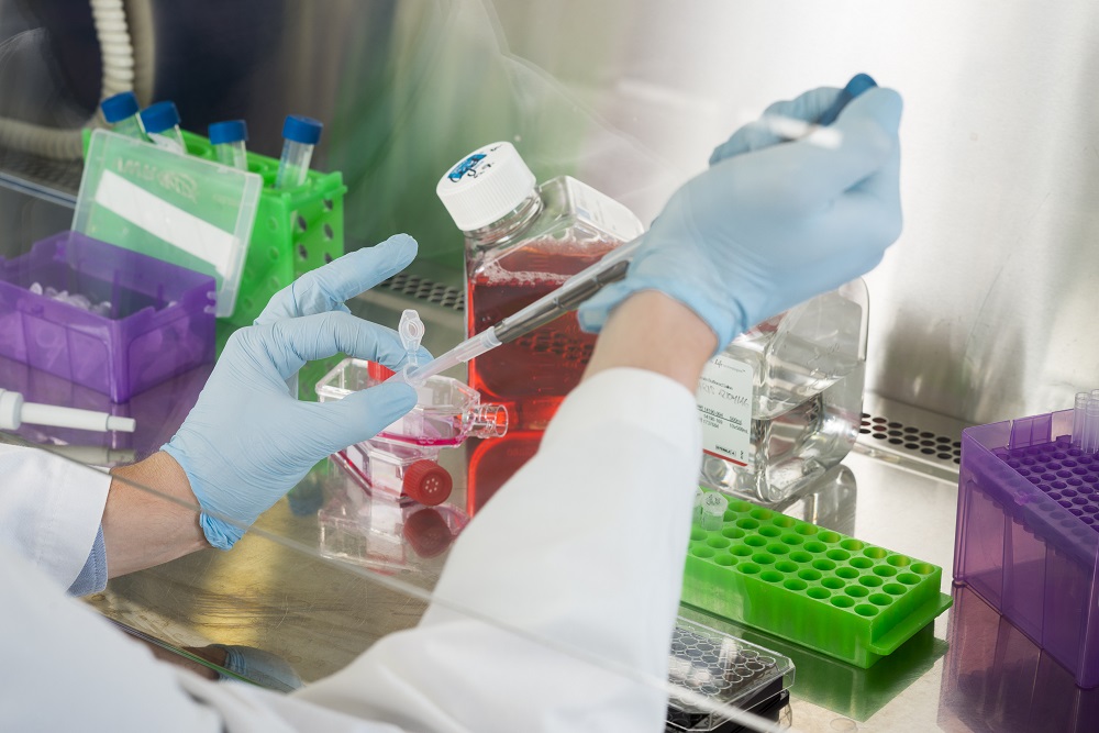 Labor_Ursachenforschung ALS Amyotrophe Lateralsklerose