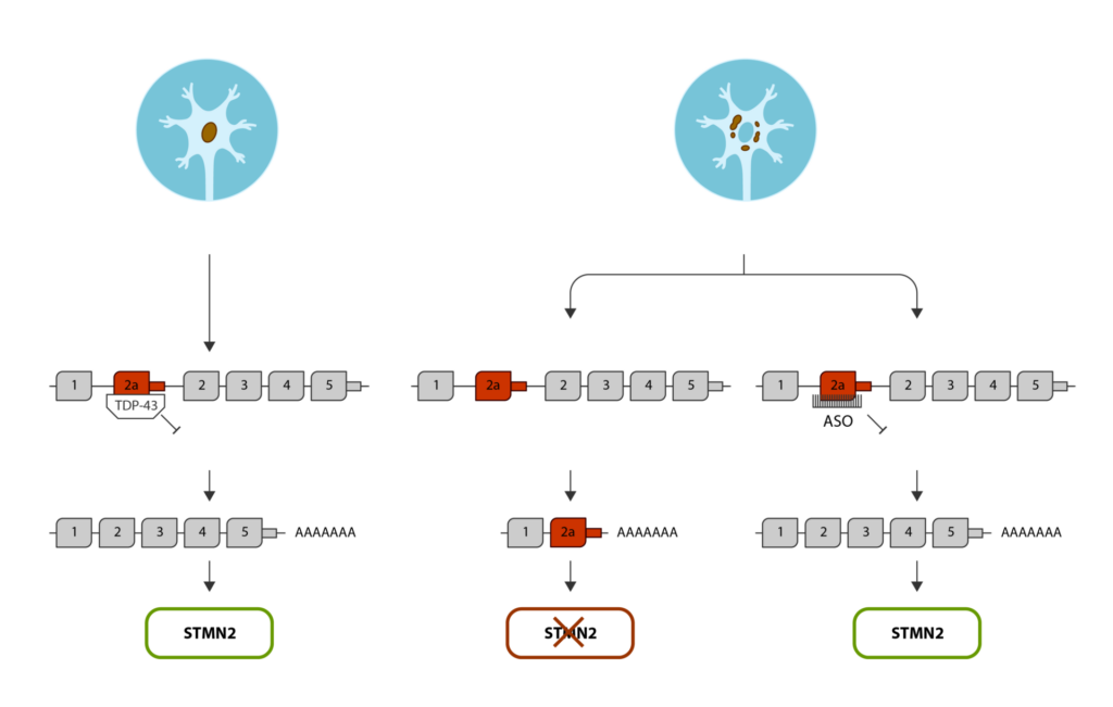 amyotrophe-lateralsklerose-als-anqur-studie-von-quralis-an-charite-gestartet