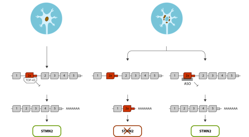 amyotrophe-lateralsklerose-als-anqur-studie-von-quralsi-an-charite-gestartet