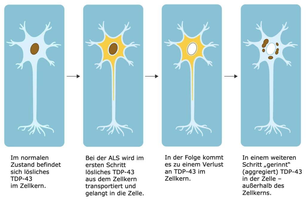 ALS-TDP-43-Aggregation