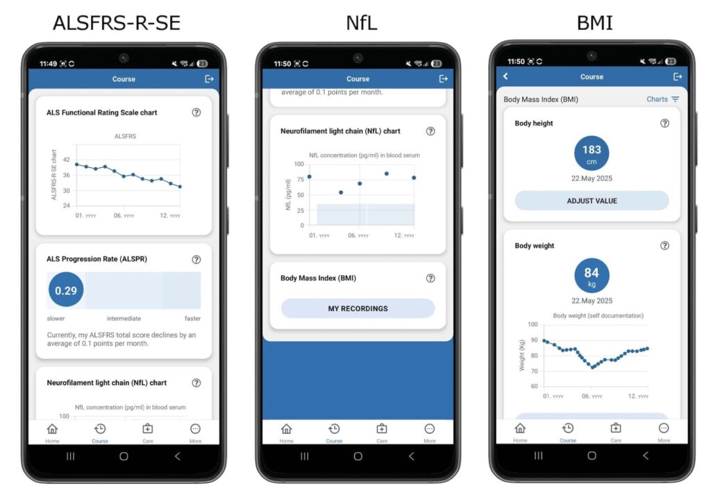 amyotrophe-lateralsklerose-als-app